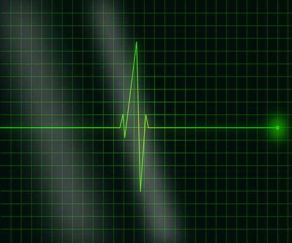 What is an Electrocardiogram machine?