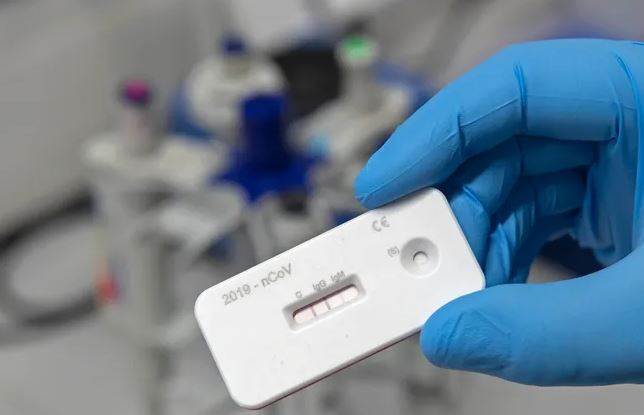 Coronavirus Pandemic : Antibody Tests In US Will Work Or Not?