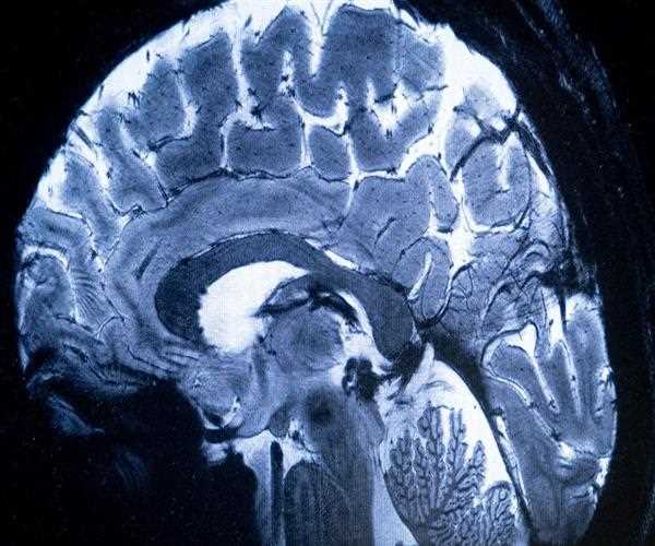 Human Brain's first images come in the World's most powerful MRI machine