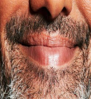 Why do males have beards but women don't?