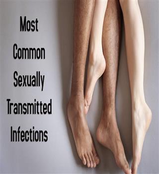 The Most Common Sexually Transmitted Infections