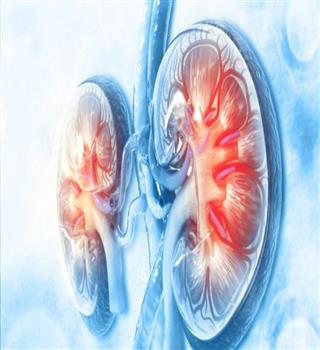10 Signs You May Have Kidney Disease