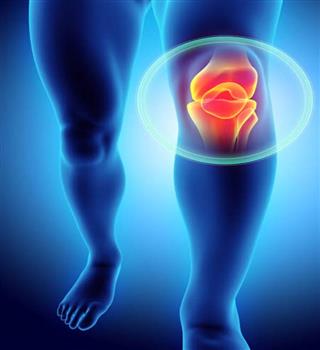 5 foods should you avoid if you are suffering from knee pain