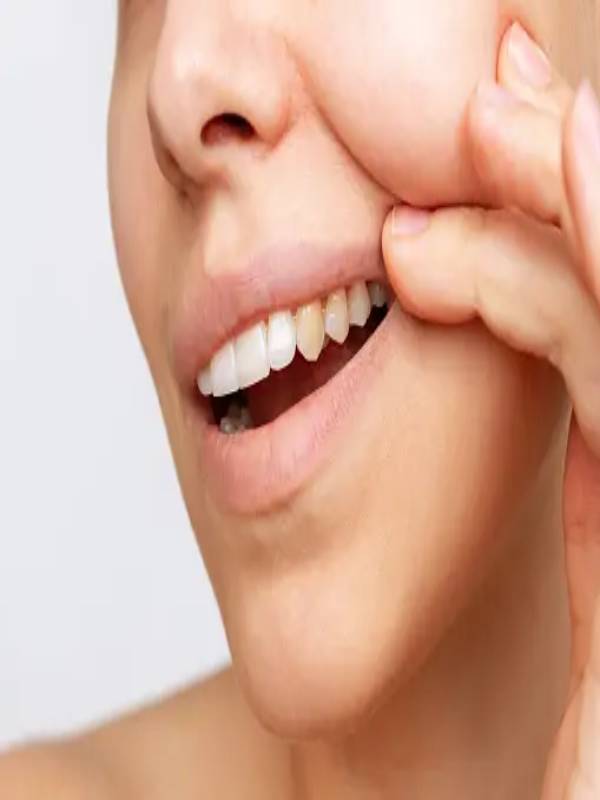 does-coffee-make-your-teeth-yellow-mindstick-yourviews-mindstick