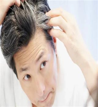 Why do young people get grey hair?