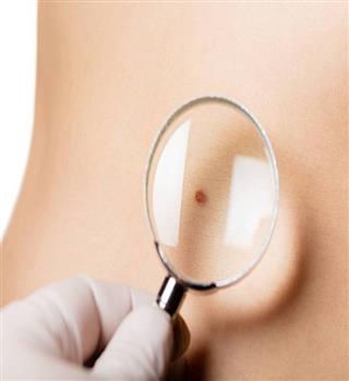 Why do we have moles in our body?
