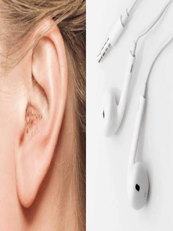 Does earphones damage your ears? MindStick YourViews MindStick