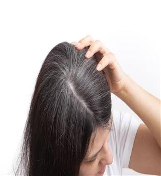How to prevent white hair from spreading naturally at home?