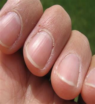 Sign of healthy nail person