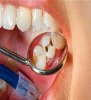 10 Common Dental Problems