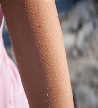 Why do we get goosebumps?