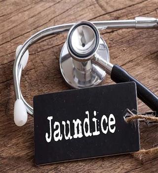 Jaundice & Its types :