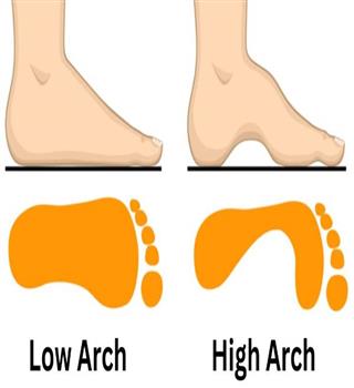 5 unknown facts about the low arch and high arch