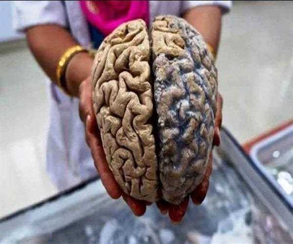 Indian Brain Vs Chinese Brain- In Figures