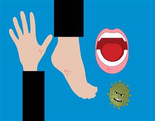 Why do my hands and feet Itch?