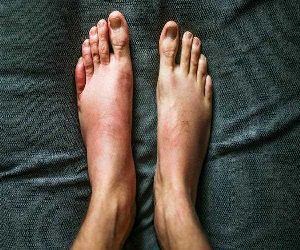 What is Vajradanti its Health Benefits