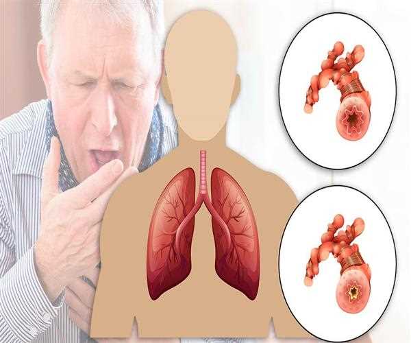 What is Vajradanti its Health Benefits