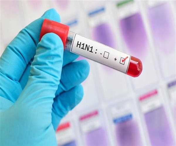 Influenza A or H1N1 cases surge in India