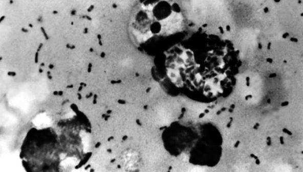 After Coronavirus Pandemic China Brings Bubonic Plague 