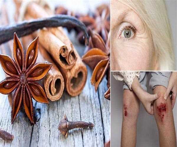 Health Benefits of Star Anise