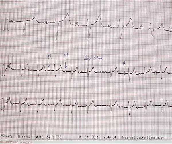 What are the Basic Principles using in ECG?