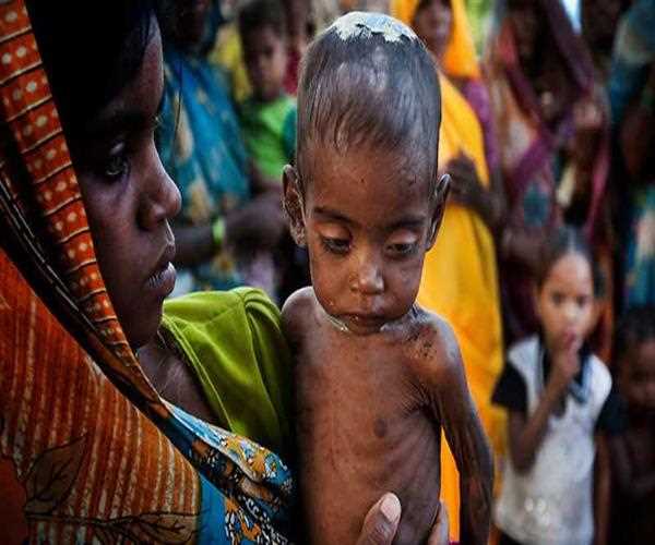 Malnutrition: Eradicating the strength of our country